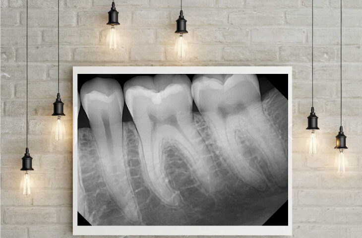 Art of a dental x ray image